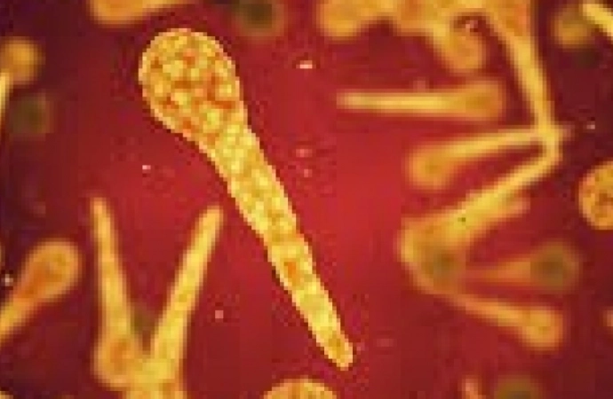 {Warmińsko-mazurski Sanepid informuje o wykryciu przypadków zachorowań na świńską grypę oraz na odrę.}